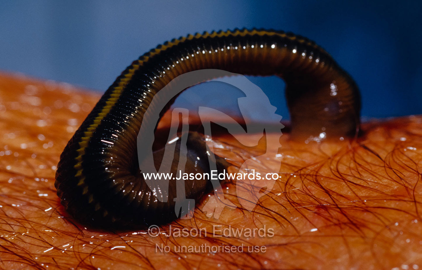 A Freshwater Leech attaches and feeds on a persons arm. Echuca, Victoria, Australia.