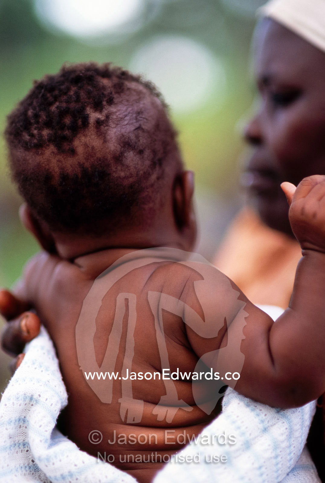 A baby with rolls of fat at a HIV AIDS Post Test Club meeting. Tororo District, Uganda.