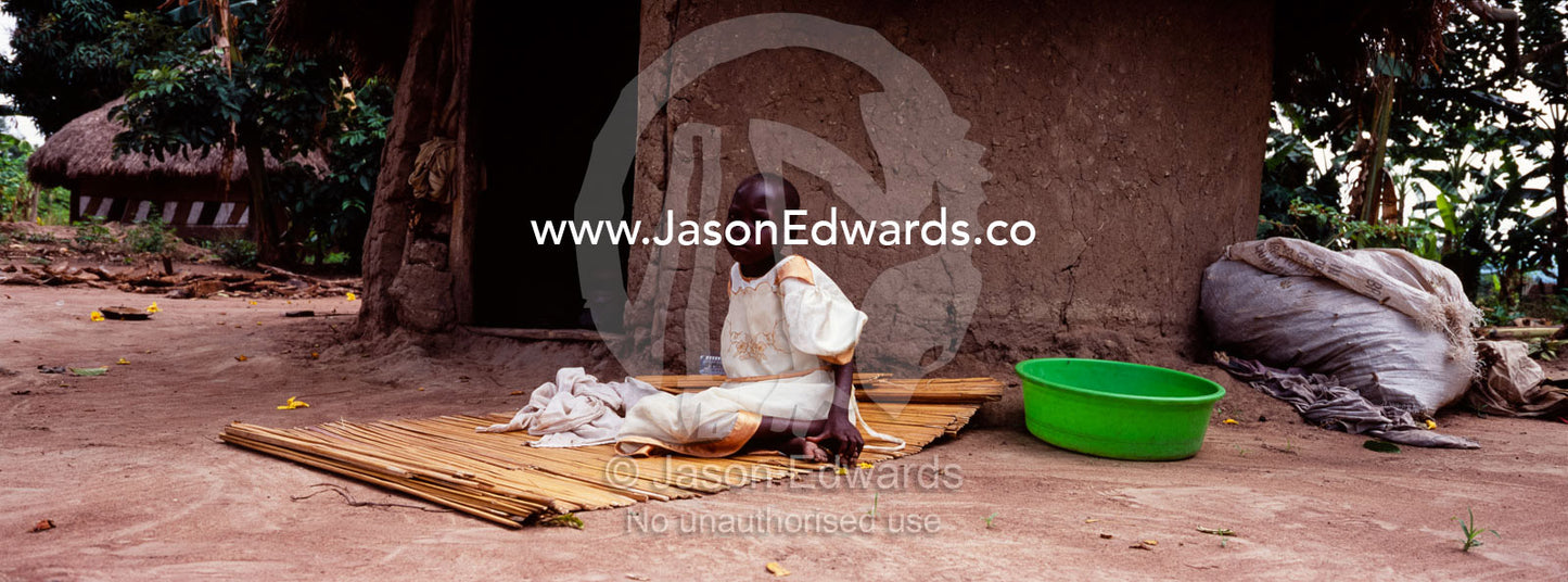 A young African girl suffering from Tuberculosis and HIV AIDS resting. Tororo District, Uganda.
