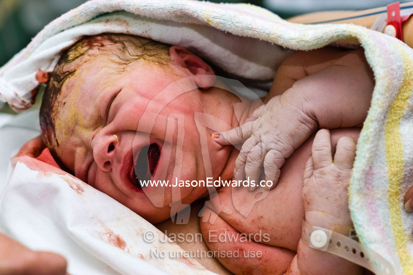 A newborn baby wails to the world his great displeasure at being born. Frances Perry House, Melbourne, Victoria, Australia.