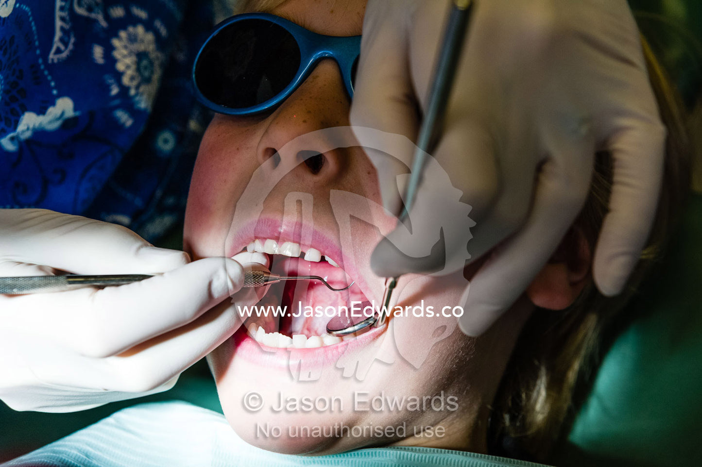 A dentist uses a sickle probe and a mirror to examine a boys teeth. East Melbourne, Melbourne, Victoria, Australia.