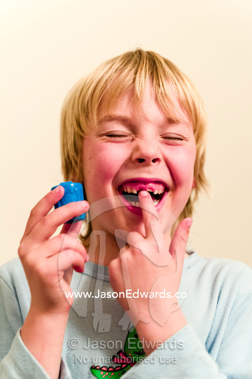 A boy displays the gap where his tooth has fallen out and his tooth fairy capsule. Carlton North, Melbourne, Victoria, Australia.