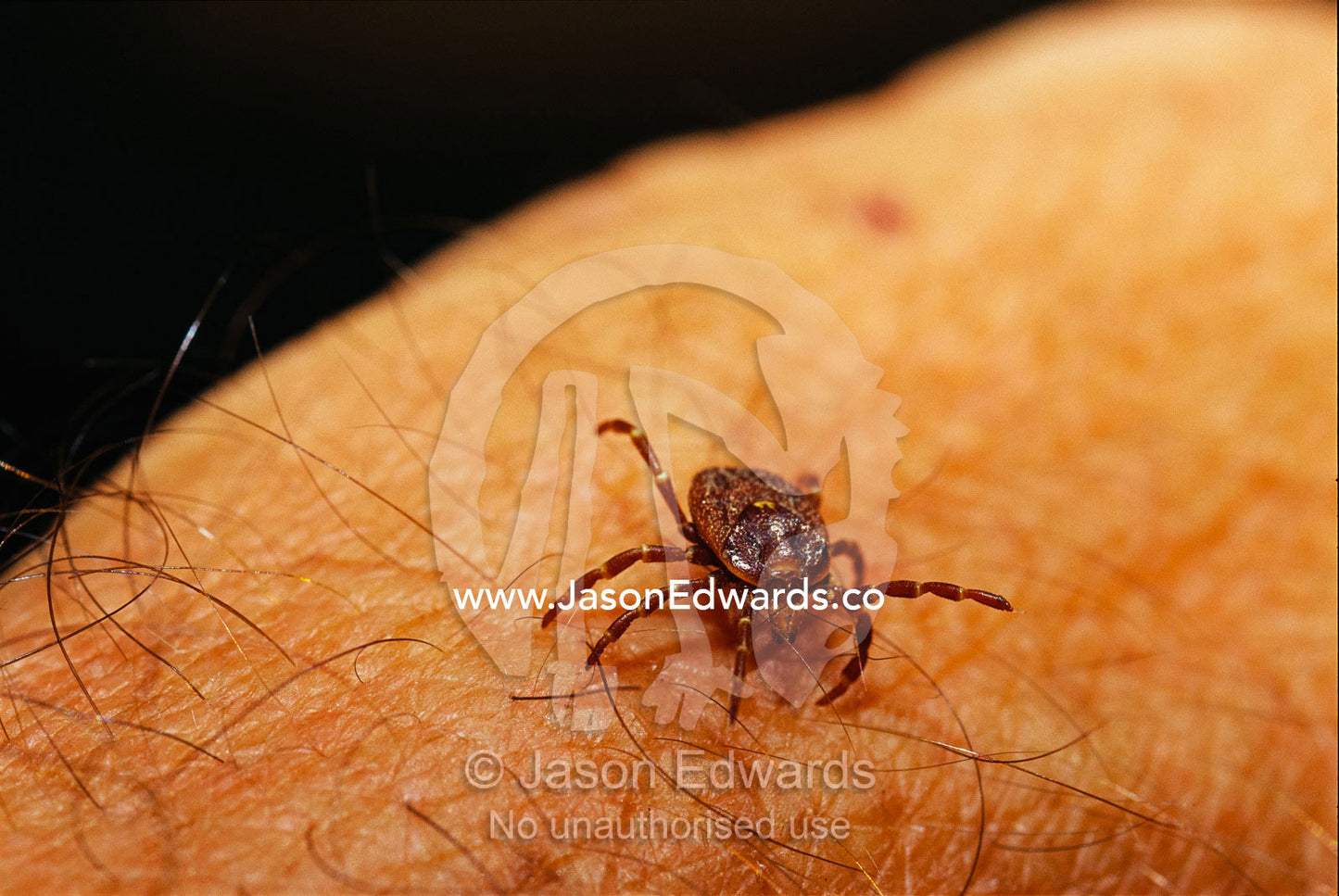 Grass or bull dog tick on a human arm. Epping National Park, Queensland, Australia.