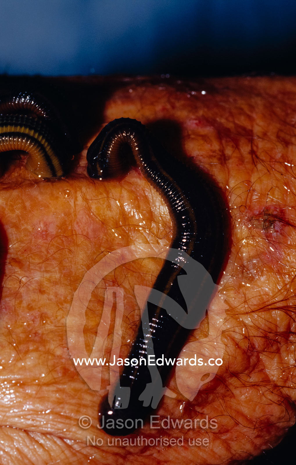 A Freshwater Leech attaches and feeds on a persons hand. Echuca, Victoria, Australia.
