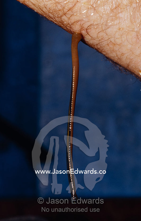 A Freshwater Leech attaches and feeds on a persons arm. Echuca, Victoria, Australia.