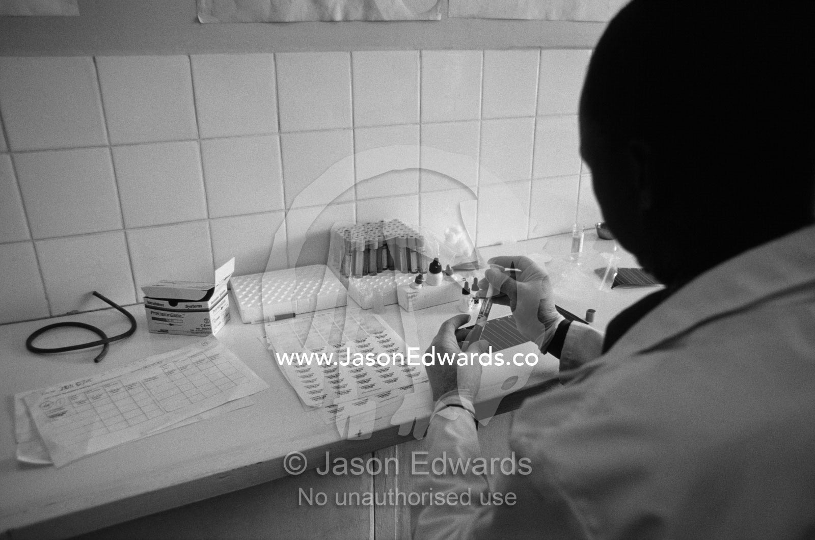 A doctor in a community hospital tests a blood sample for HIV AIDS. Tororo District Hospital, Uganda.
