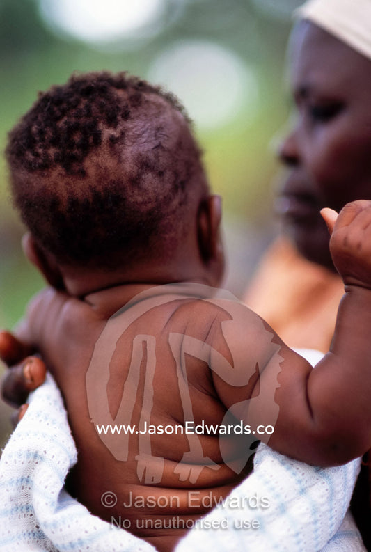 A baby with rolls of fat at a HIV AIDS Post Test Club meeting. Tororo District, Uganda.