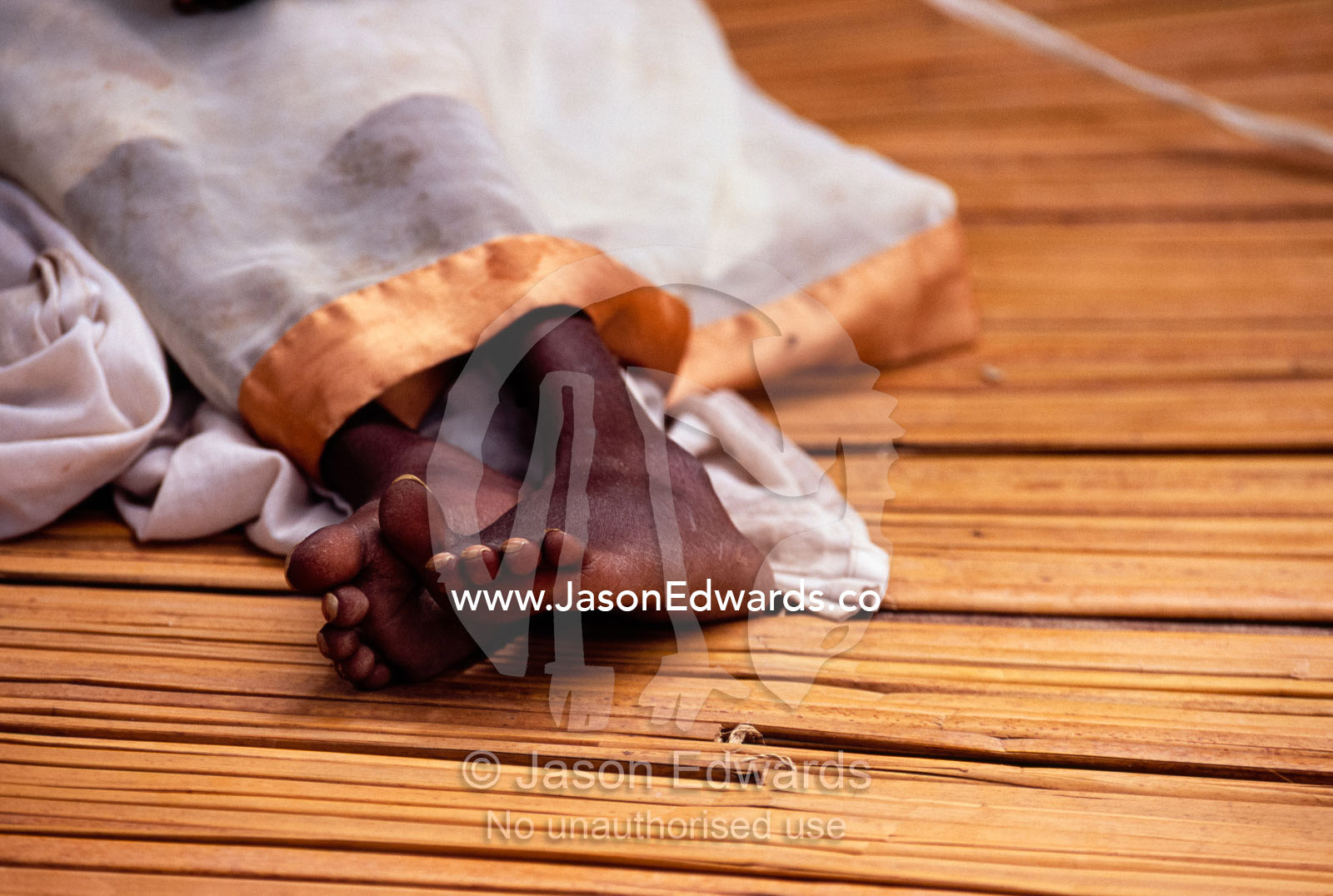 The tiny feet of a young girl suffering from AIDS and Tuberculosis. Tororo District, Uganda.
