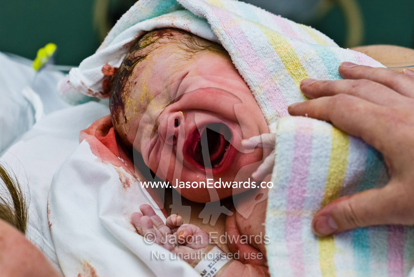 A newborn baby wails to the world his great displeasure at being born. Frances Perry House, Melbourne, Victoria, Australia.