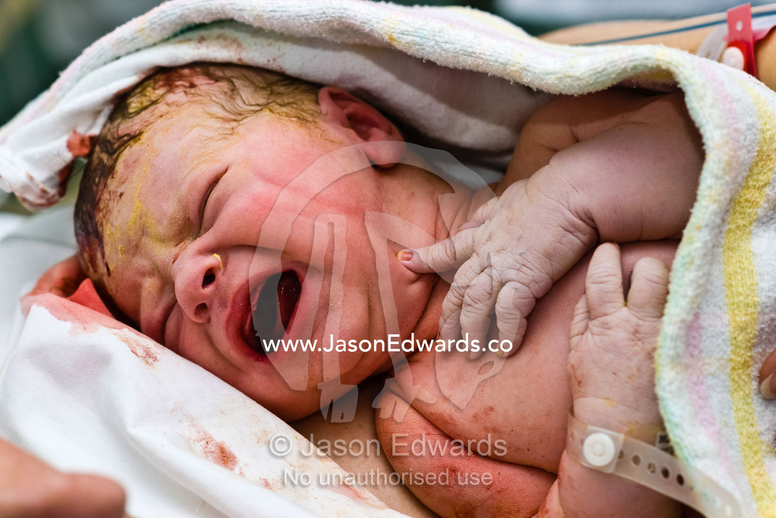 A newborn baby wails to the world his great displeasure at being born. Frances Perry House, Melbourne, Victoria, Australia.