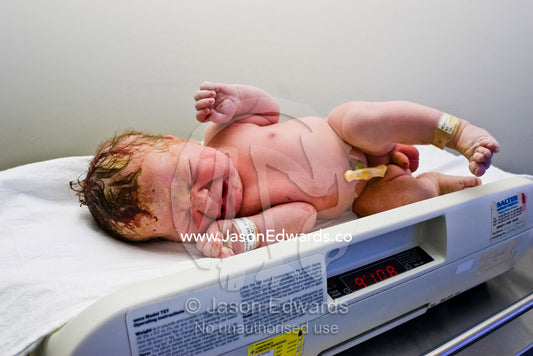 A very unhappy newborn baby is weighed on digital scales after birth. Frances Perry House, Melbourne, Victoria, Australia.