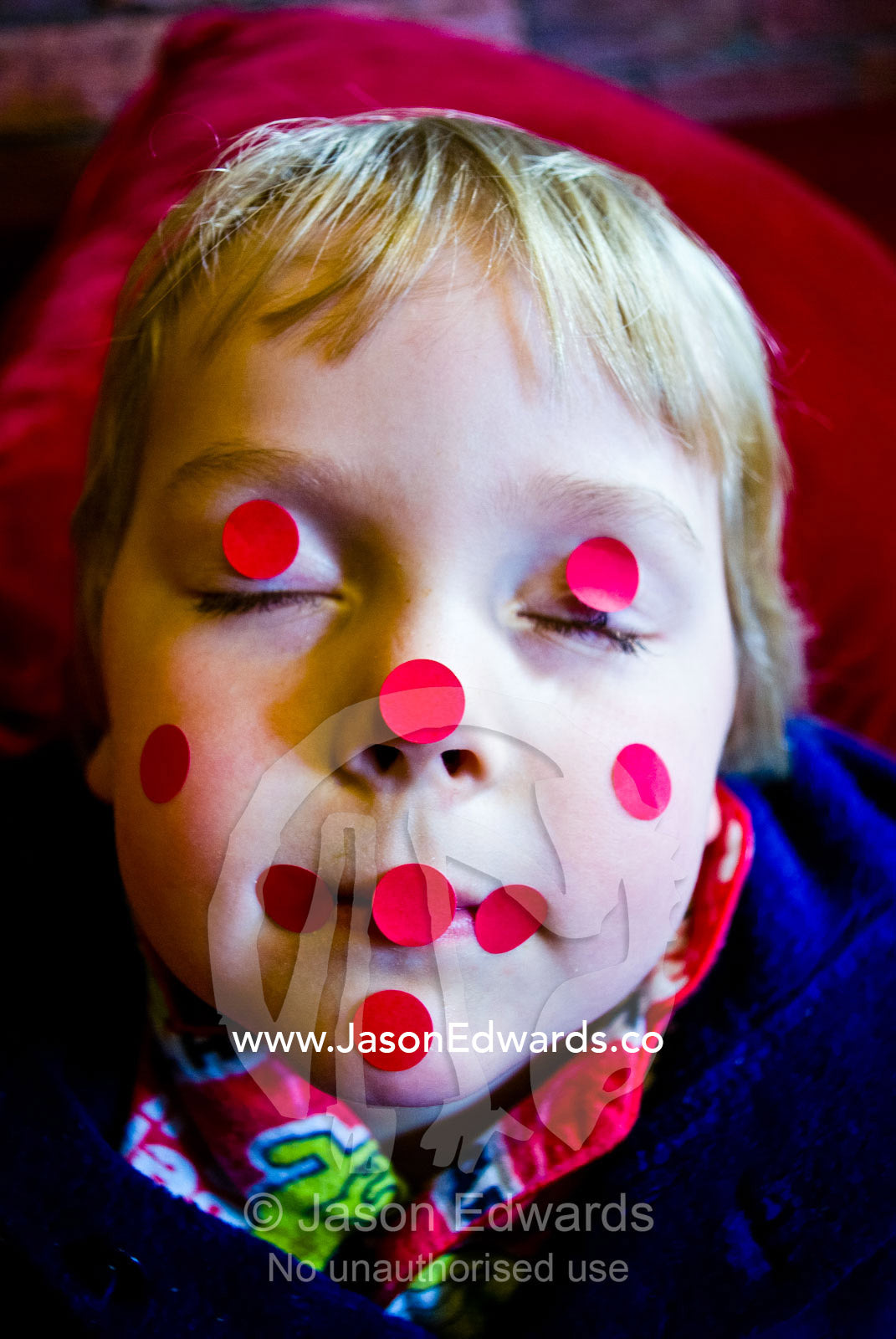 A boy pretending to be asleep with red sticky dots on his face. Carlton North, Melbourne, Victoria, Australia.