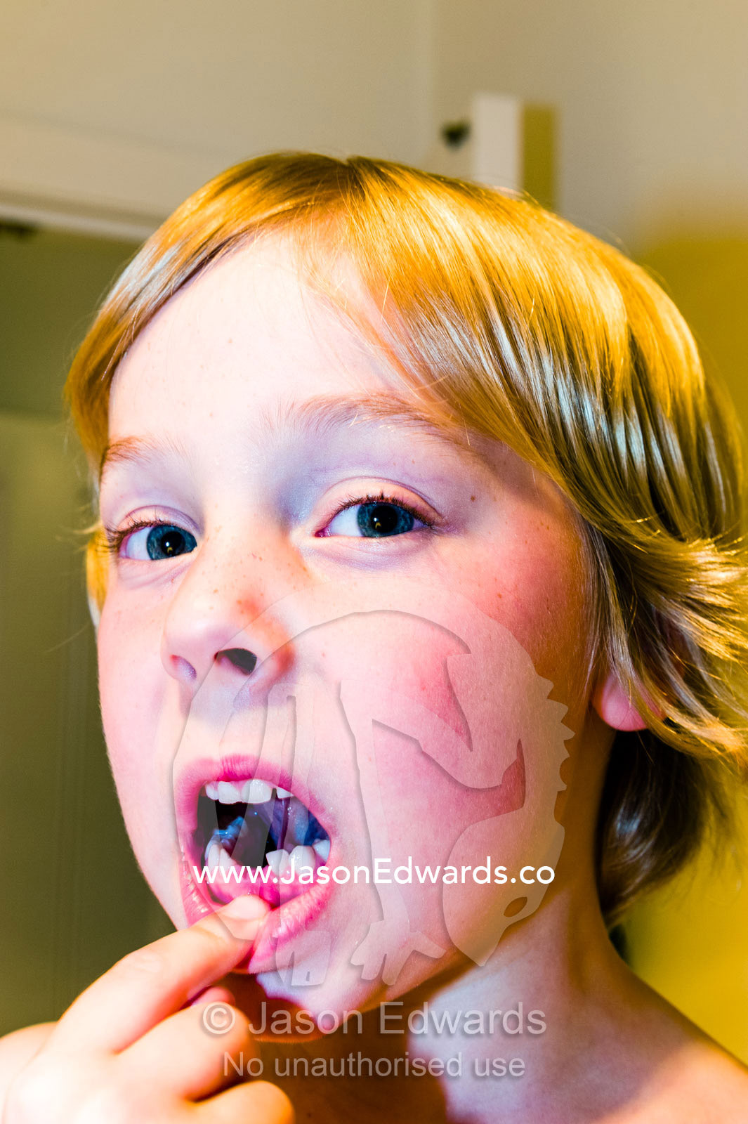 A boy displays the gaps where his first two baby milk teeth fell out. Carlton North, Melbourne, Victoria, Australia.