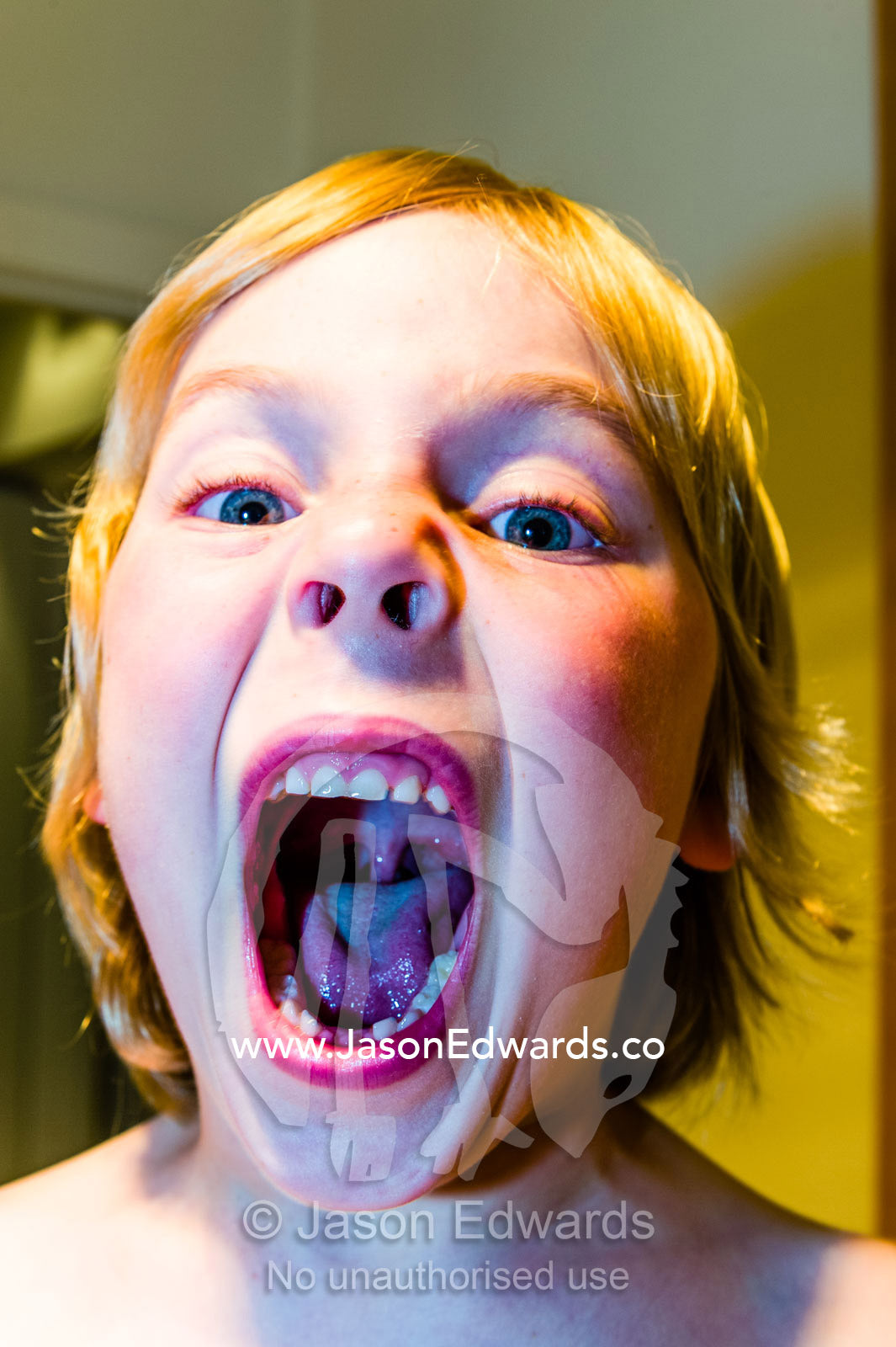 A boy displays the gaps where his first two baby milk teeth fell out. Carlton North, Melbourne, Victoria, Australia.