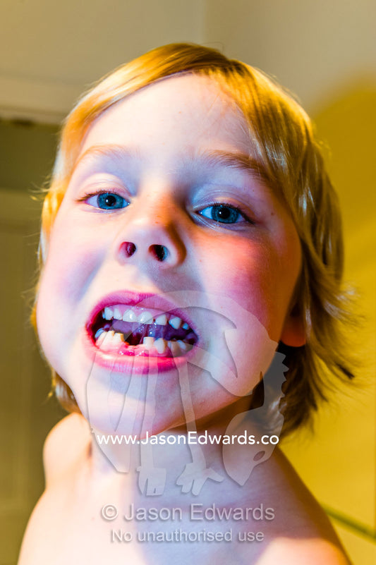 A boy displays the gaps where his first two baby milk teeth fell out. Carlton North, Melbourne, Victoria, Australia.