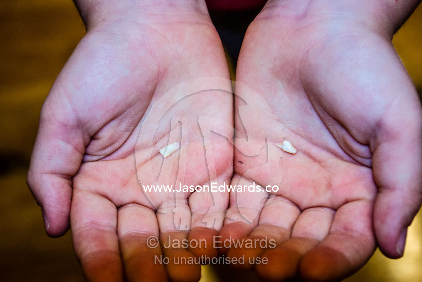 A boy proudly displays his first baby milk teeth that have fallen out. Carlton North, Melbourne, Victoria, Australia.