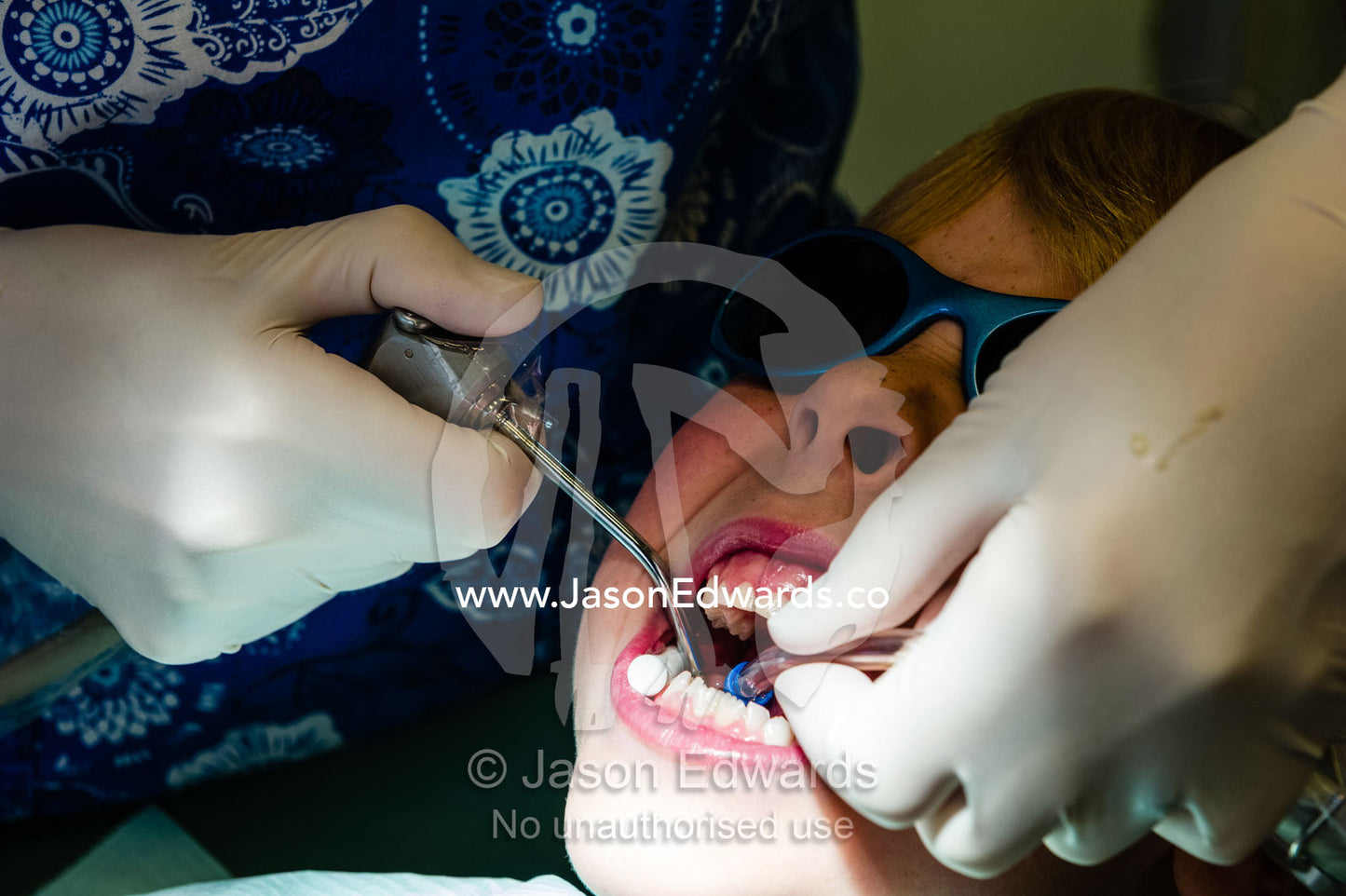A dentist uses an air and water hose and suction pipe to examine fillings in a boys molar teeth. East Melbourne, Melbourne, Victoria, Australia.