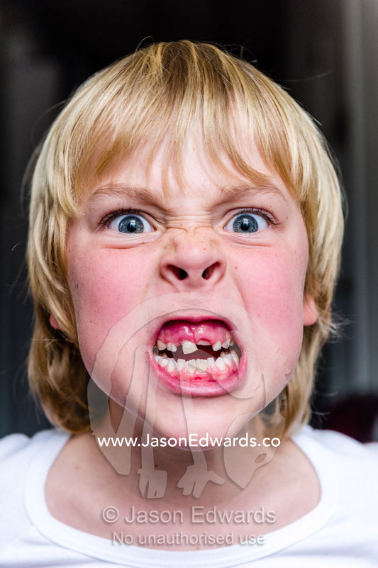 A boy making an angry face to show his missing teeth. Carlton North, Melbourne, Victoria, Australia.