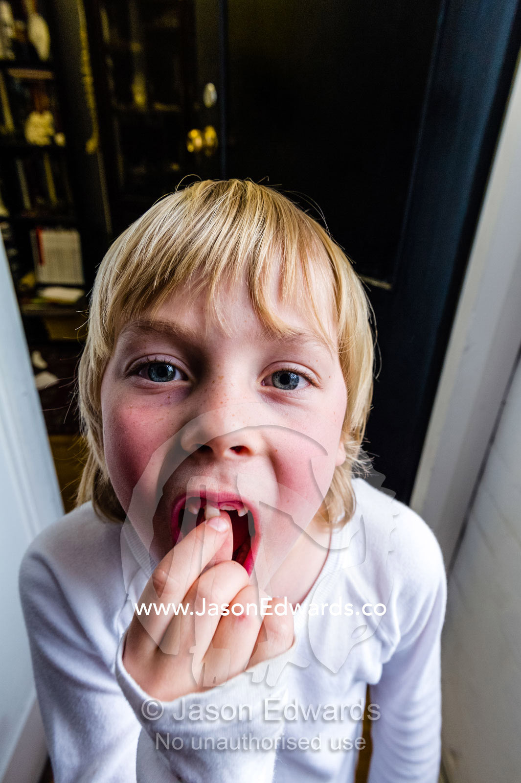 A boy wobbles his loose tooth to make it come out for the tooth fairy. Carlton North, Melbourne, Victoria, Australia.