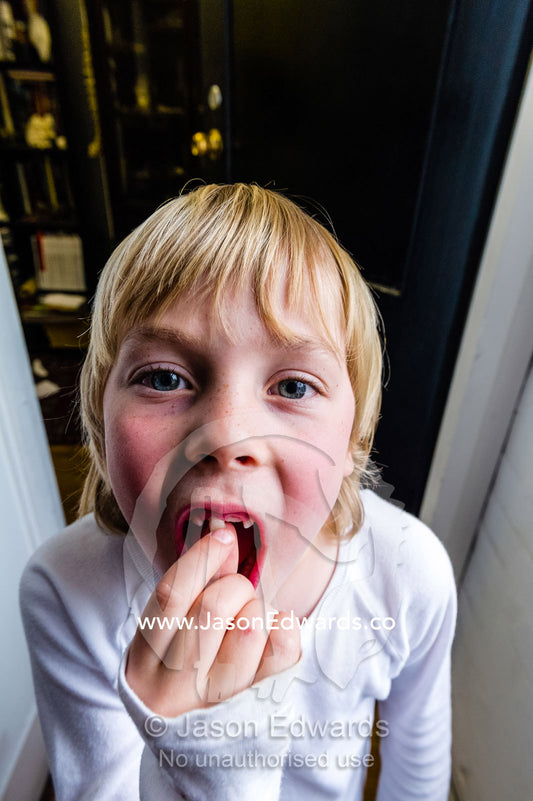 A boy wobbles his loose tooth to make it come out for the tooth fairy. Carlton North, Melbourne, Victoria, Australia.