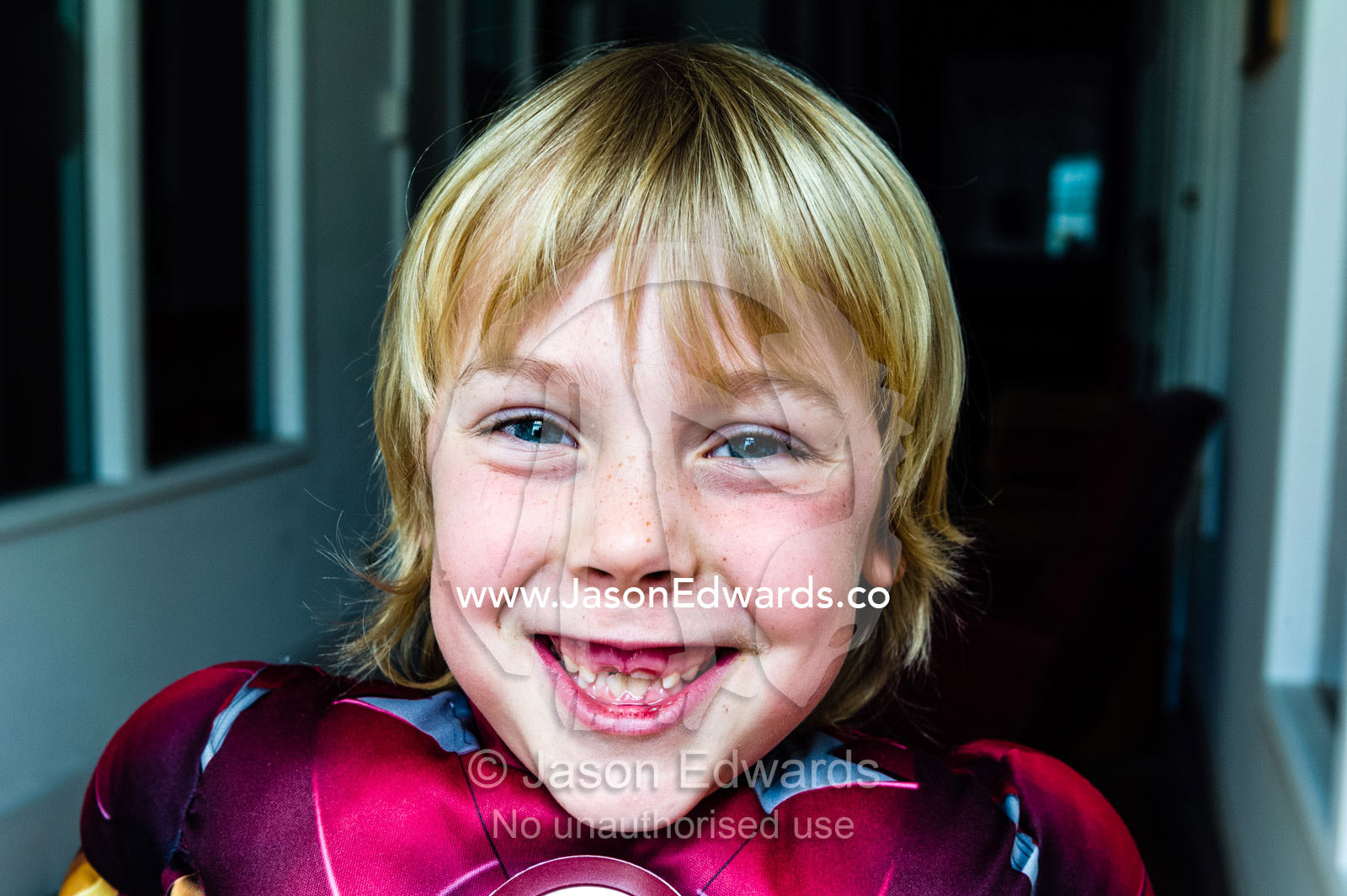 A boy laughs and displays his two missing front teeth. Collingwood, Melbourne, Victoria, Australia.