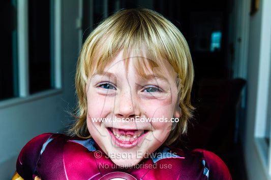 A boy laughs and displays his two missing front teeth. Collingwood, Melbourne, Victoria, Australia.