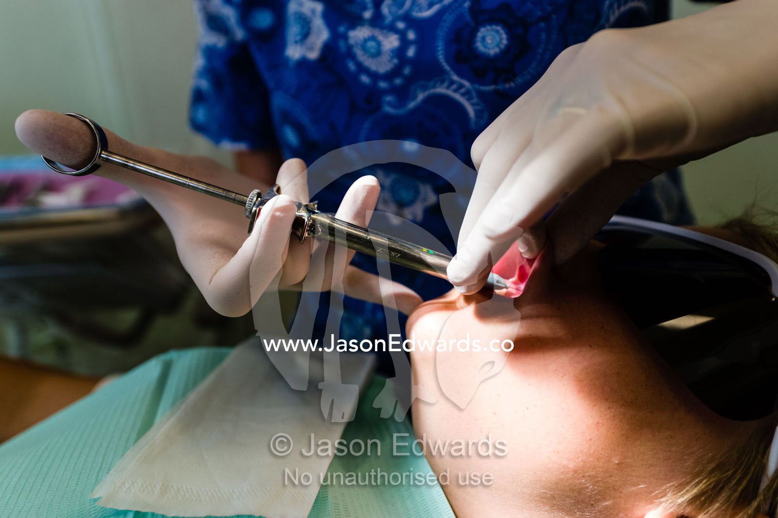 A dentist injects a boys mouth with anaesthetic to repair a broken tooth with a cap. Melbourne, Victoria, Australia.