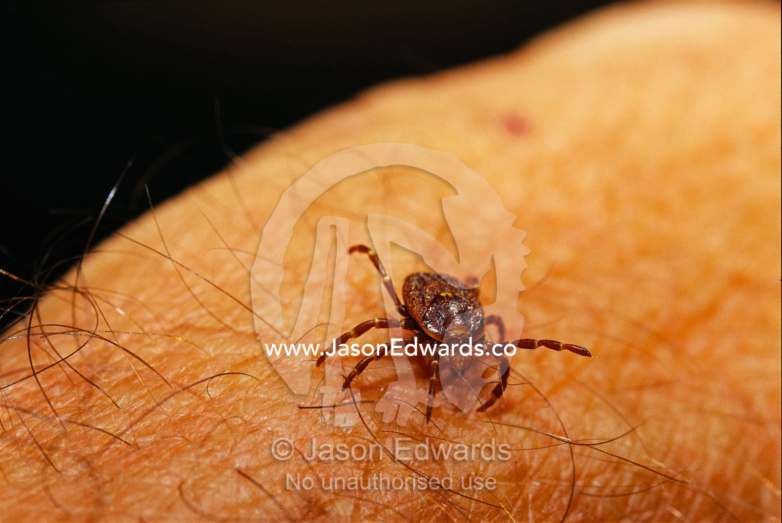 Grass or bull dog tick on a human arm. Epping National Park, Queensland, Australia.